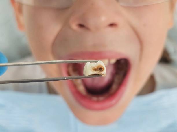 Best Cracked Tooth Emergency Dentist  in Petersburg, MI